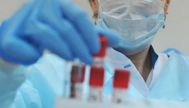 Коронавирус в Челябинской области: диагноз подтвердился у 34 человек