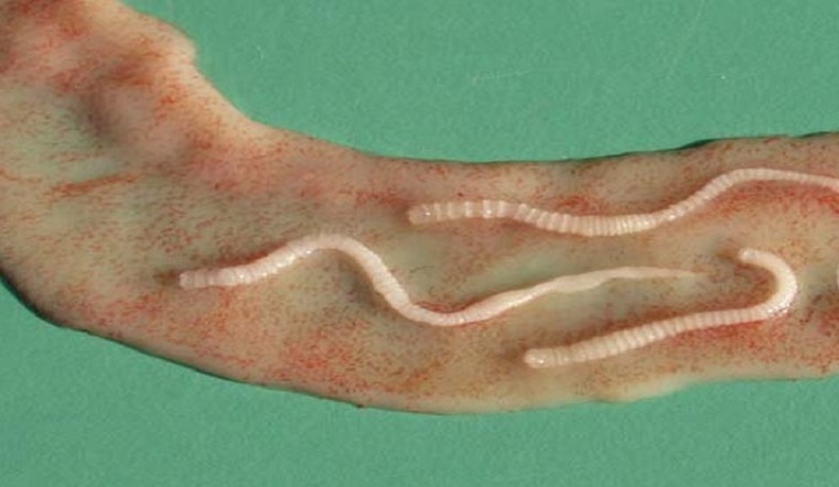 Сальмонелла, бруцелла и глисты. Как не стать жертвой бактерий этим летом Сальмонелла, бруцелла и глисты. Как не стать жертвой бактерий этим летом