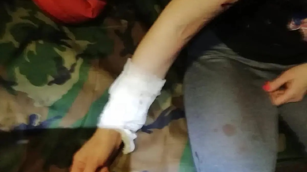 Женщину с травмами и ожогами эвакуировали из высокогорного приюта нацпарка Таганай