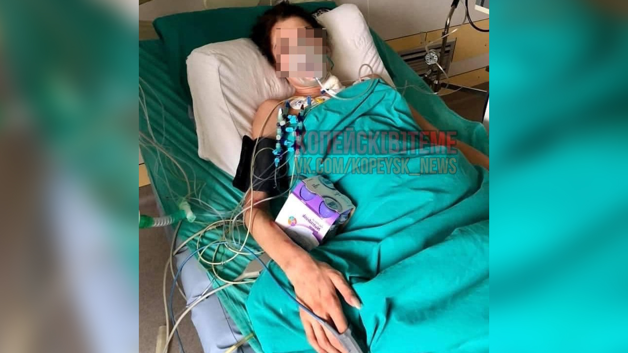 Выпили ядовитый компот: в Челябинской области одна женщина скончалась, вторая в больнице