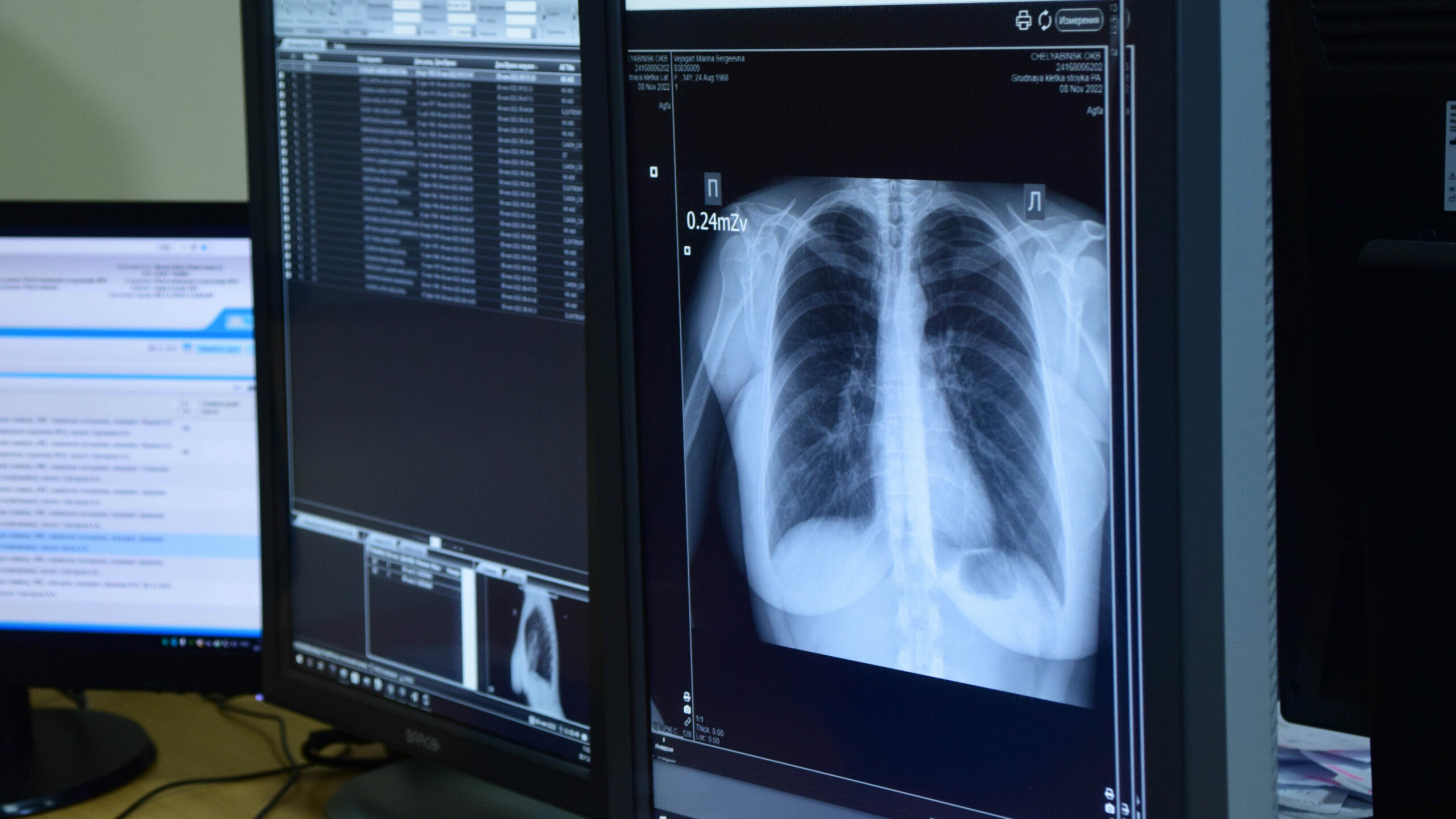 Видят насквозь: рентгенологи в Челябинске рассказали, как "высвечивают" болезни