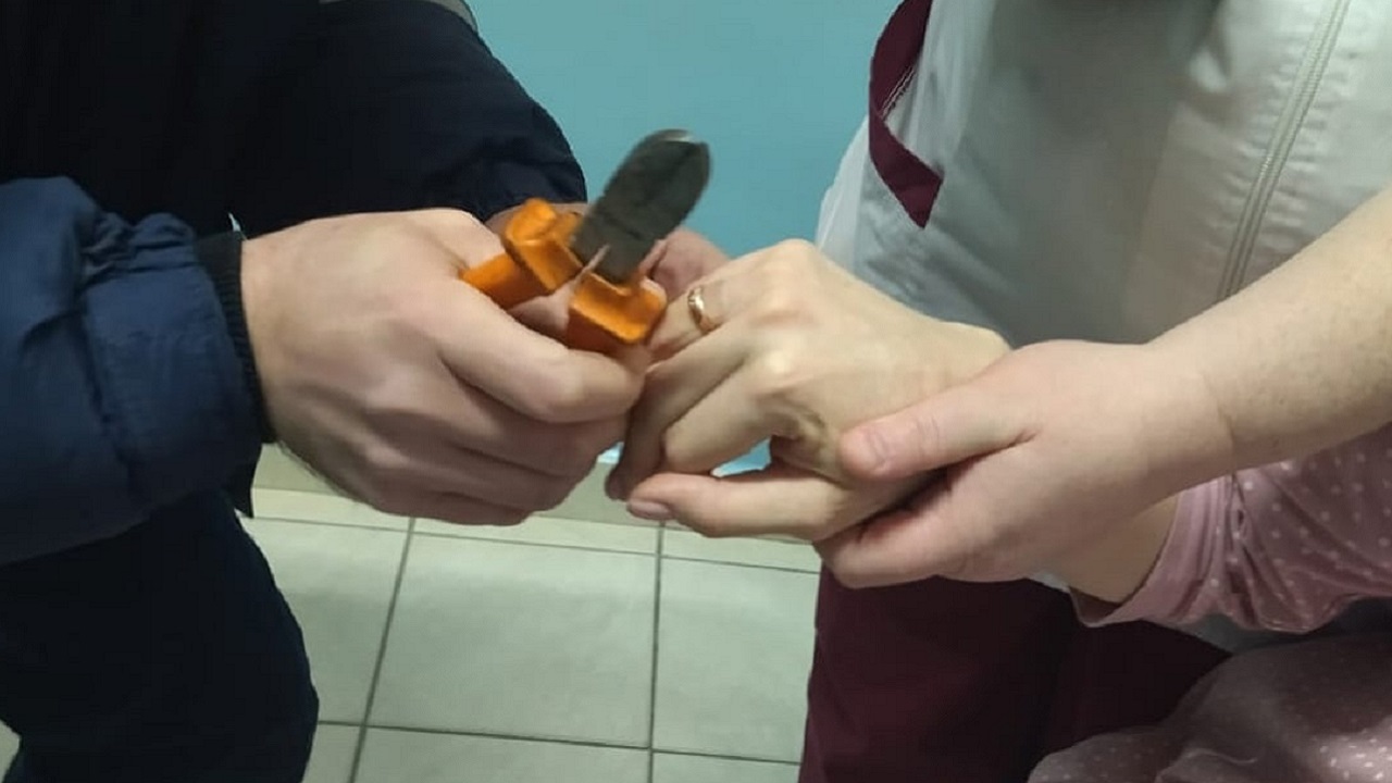 В Челябинской области спасатели помогли беременной снять кольцо с опухшего пальца