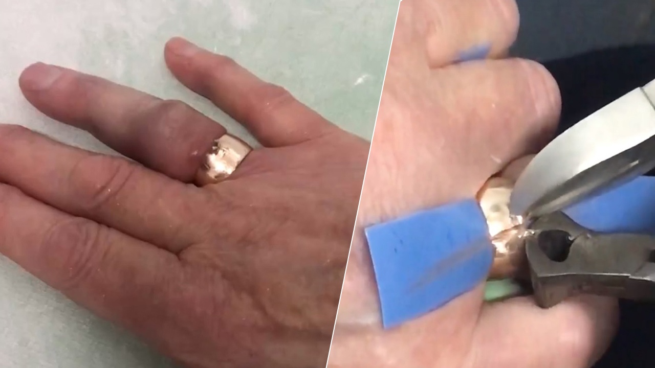 Снять кольцо через 50 лет: на Урале спасатели помогли бабушке освободить опухший палец