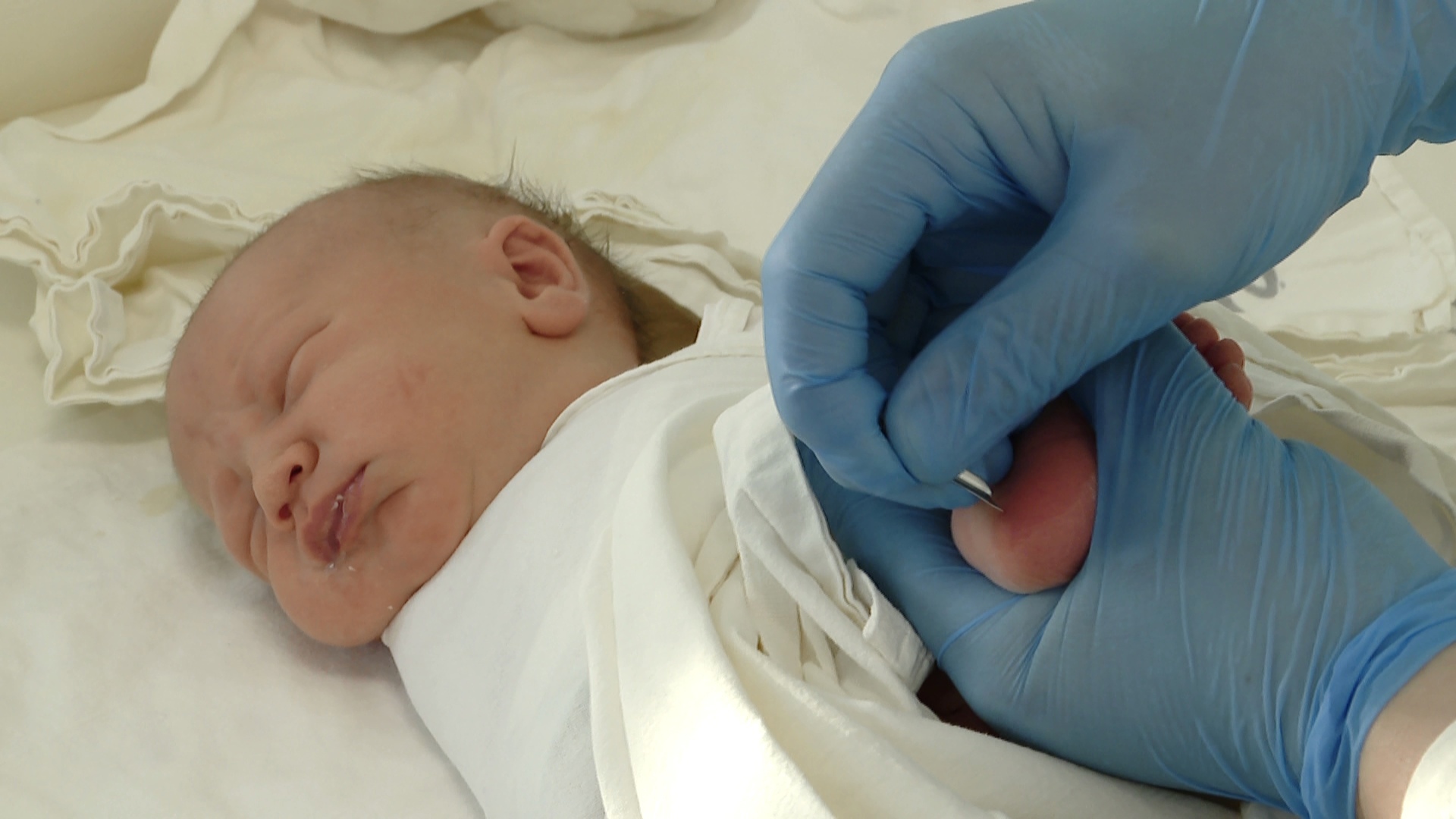 Расширенный неонатальный скрининг сделают всем новорожденным в Челябинской области
