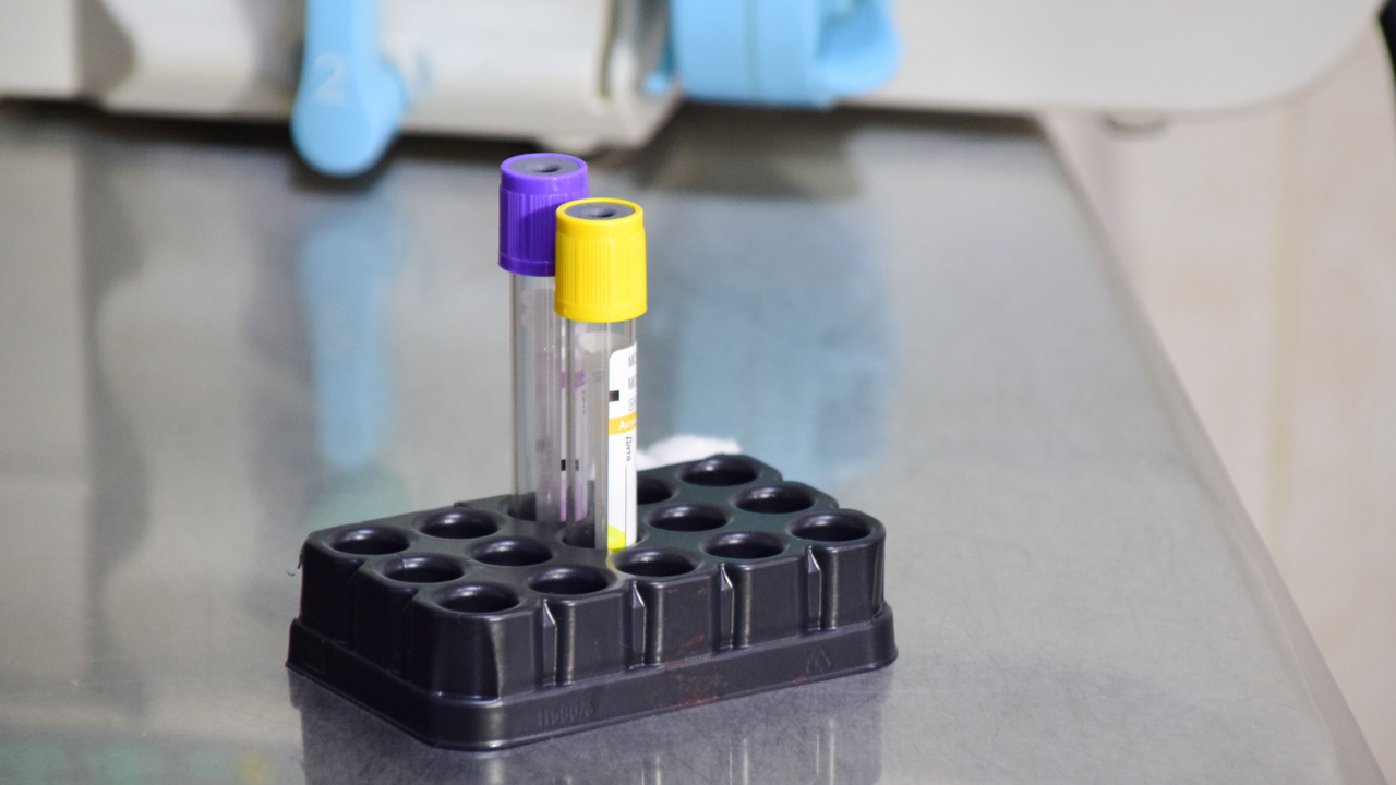 Домашняя собака умерла от бешенства в Челябинской области