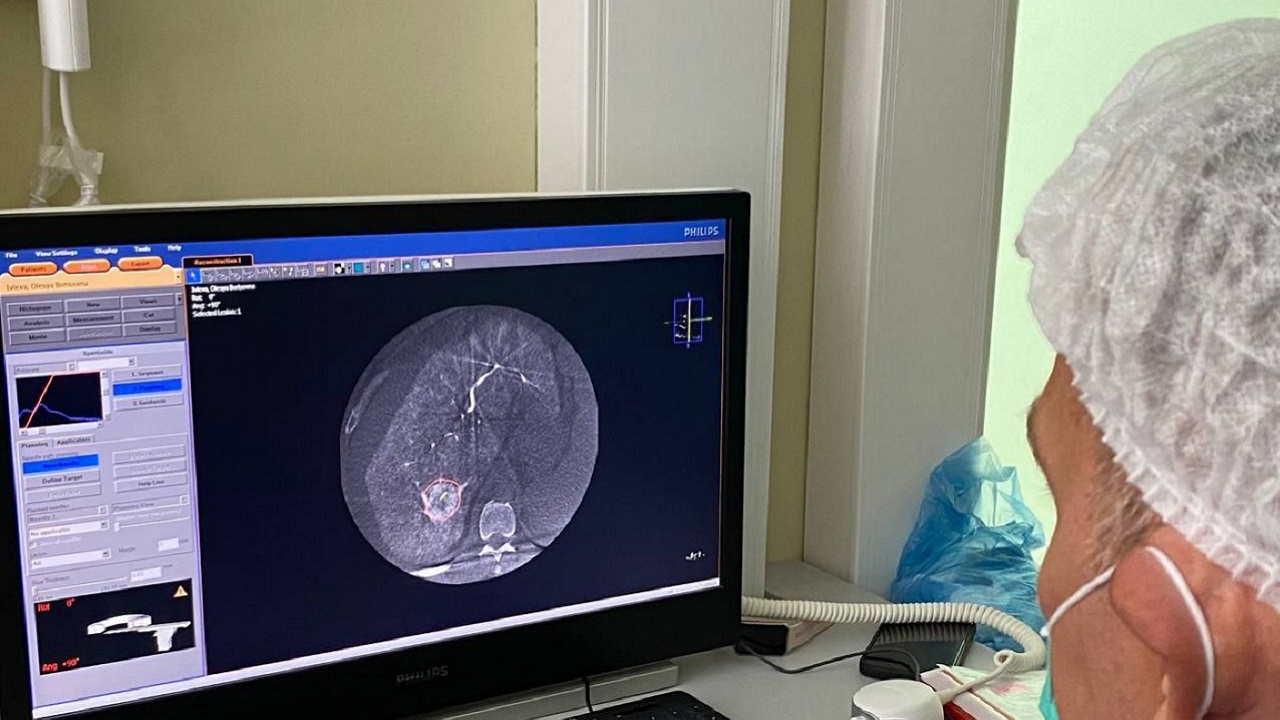 Новый метод диагностики и лечения внедряют в онокцентре в Челябинске
