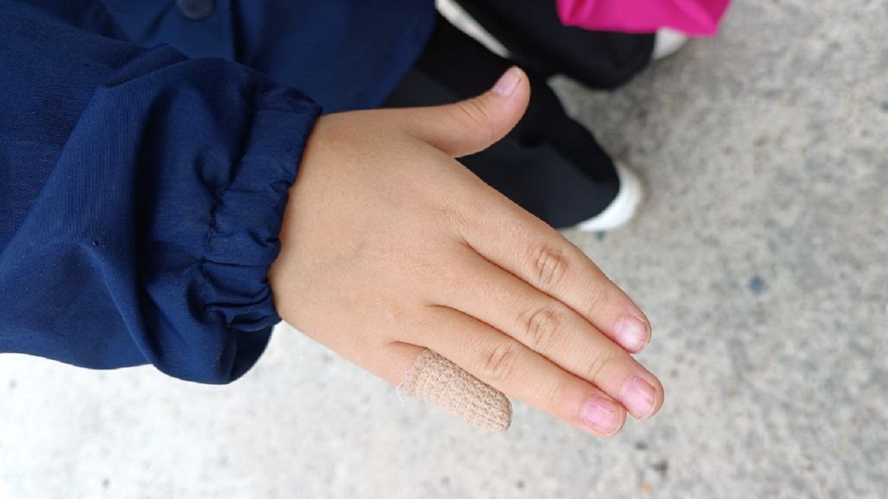 Девочка в Челябинской области лишилась фаланги пальца на детской горке: как идет расследование