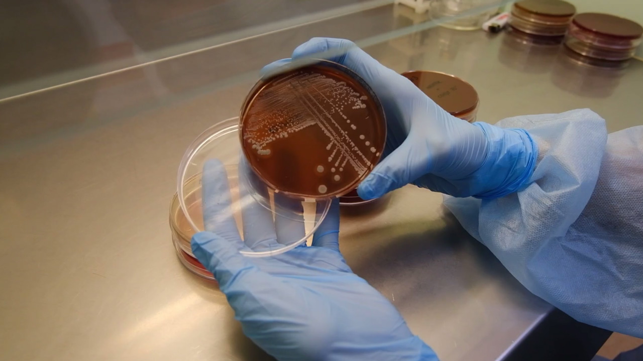 Какие бактерии живут на банке газировки: эксперимент микробиолога из Челябинска