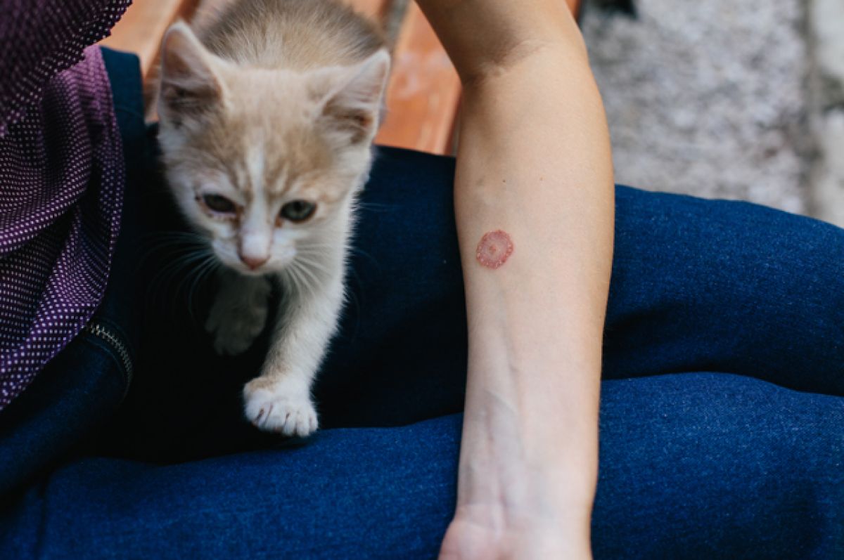 Весенняя угроза: врачи из Челябинска рассказали, чем опасен стригущий лишай 