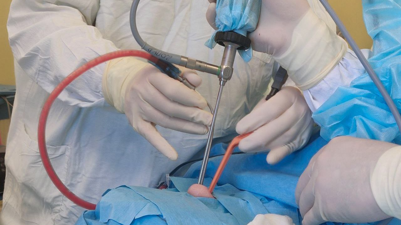 Челябинские врачи начали удалять опухоли мозга через проколы в носу
