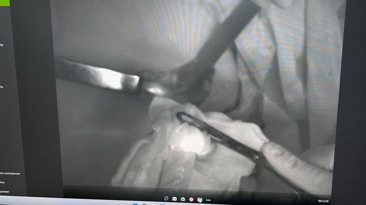 Челябинские врачи начали использовать "краситель" для борьбы с раком