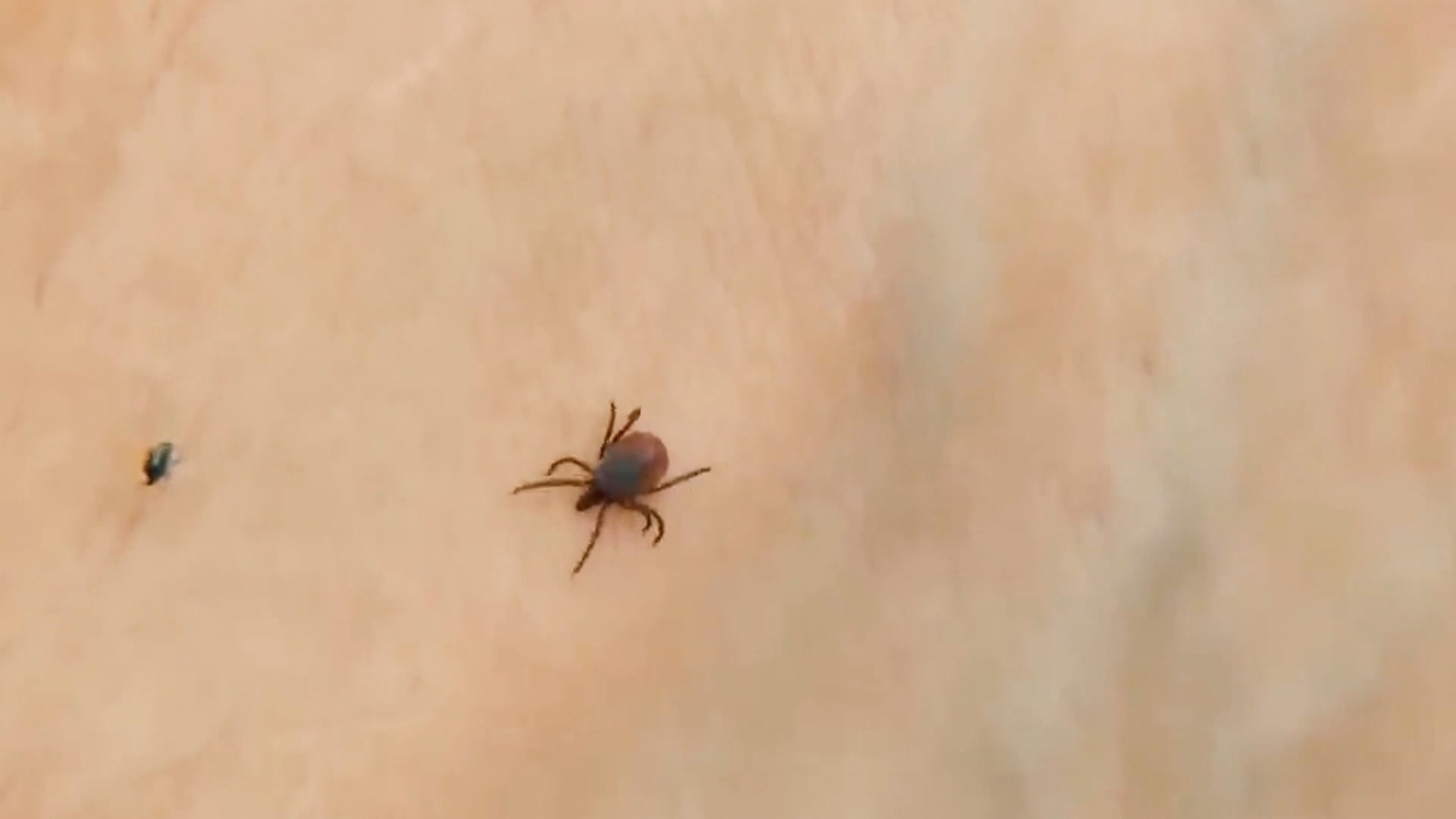10 штук за 20 минут: жители Челябинской области в шоке от активности клещей