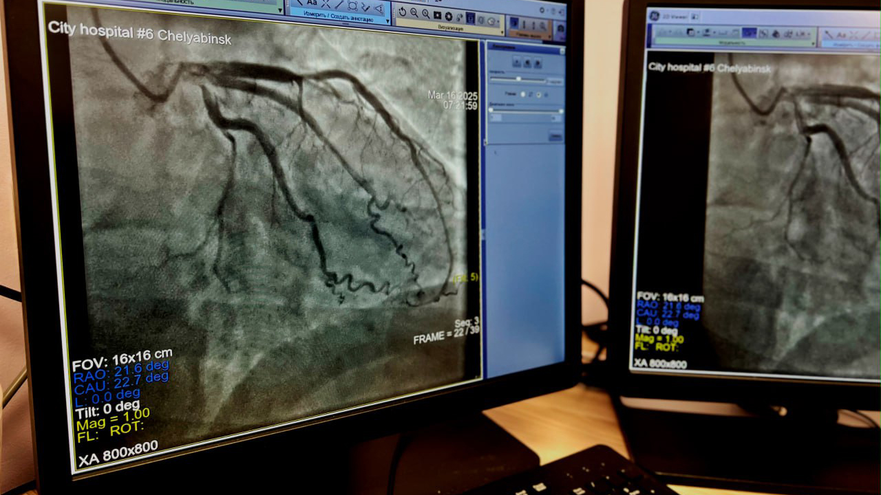 Врачи в Челябинске спасли 40-летнего мужчину с инфарктом миокарда