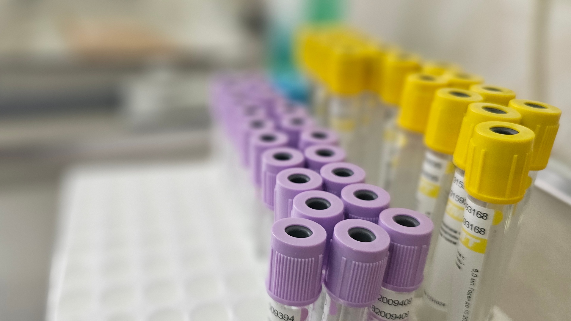 Ушли на дистант: случай кори выявили в челябинском вузе Ушли на дистант: случай кори выявили в челябинском вузе