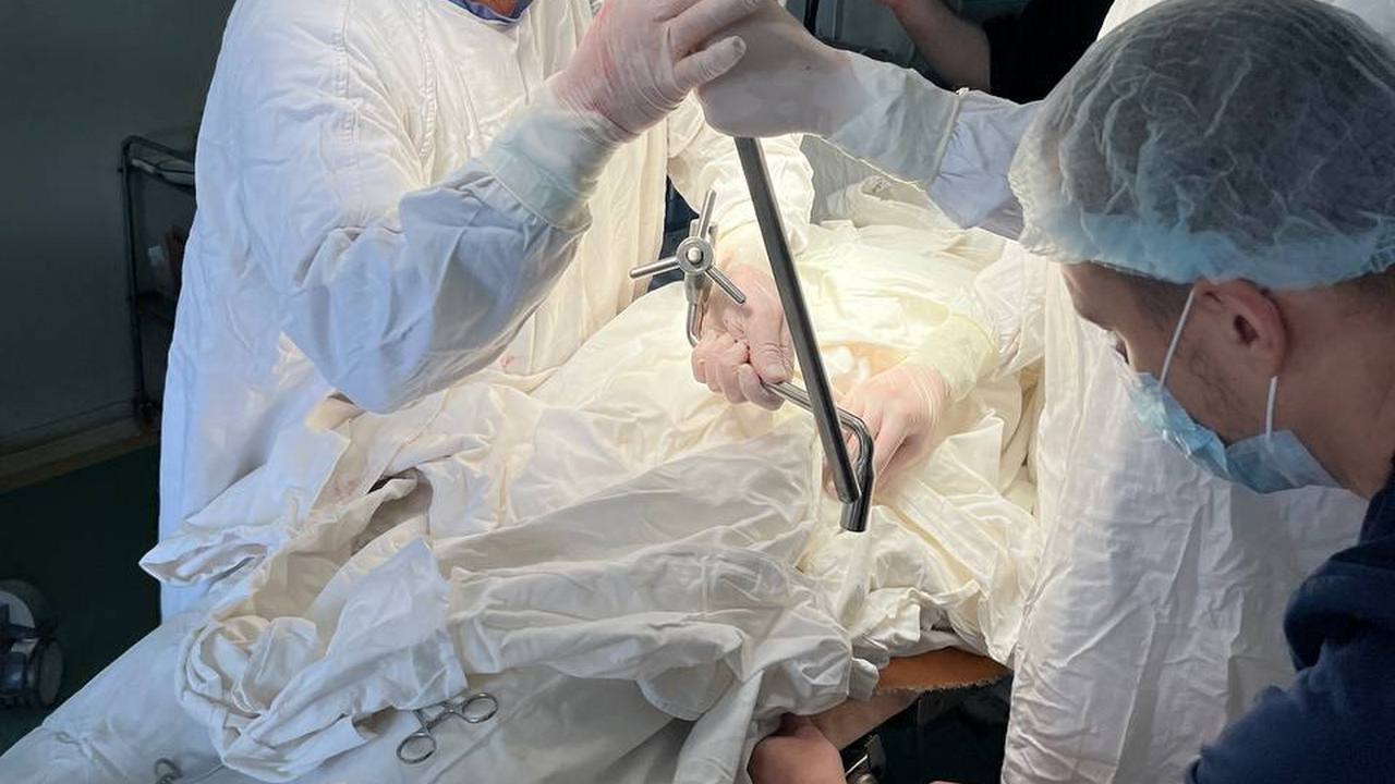 Гнездо паразитов образовалось в печени: в Челябинске врачи спасли 44-летнего пациента