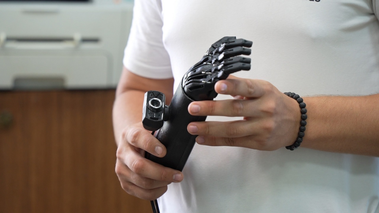 В Челябинской области "оживили" протез руки с помощью ИИ