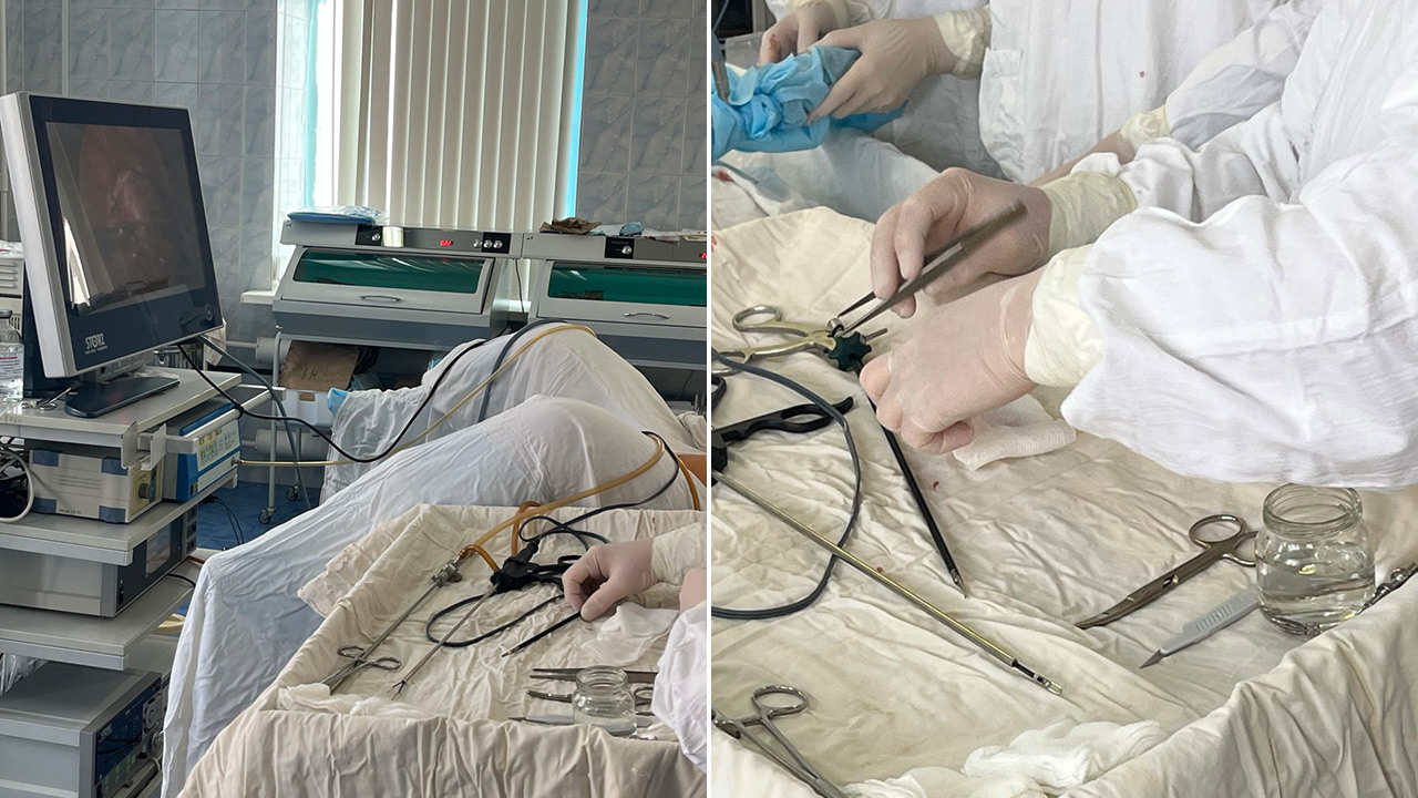 В Челябинске спасли беременную пациентку с редкой патологией