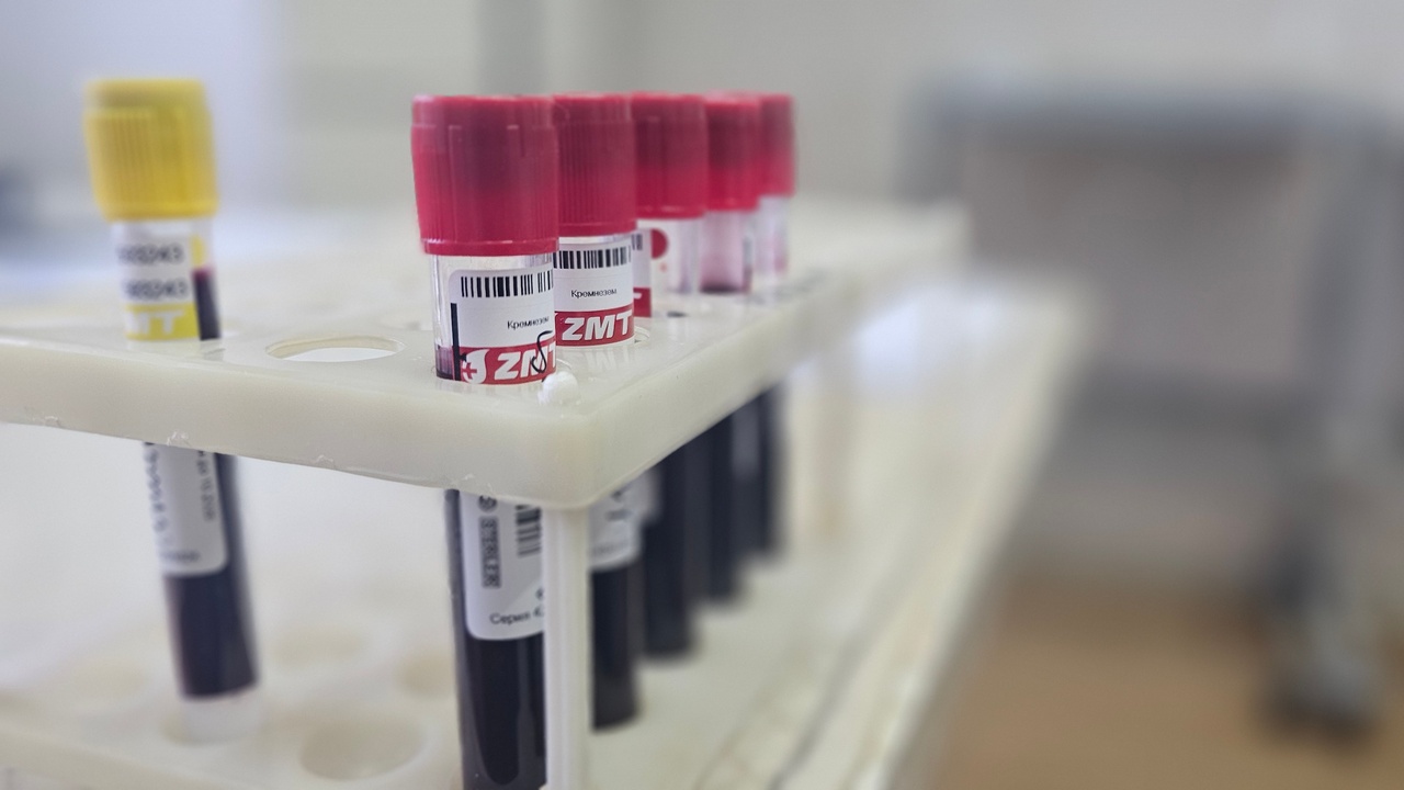 Генетик из Магнитогорска назвала болезни, которые чаще передаются по наследству Генетик из Магнитогорска назвала болезни, которые чаще передаются по наследству