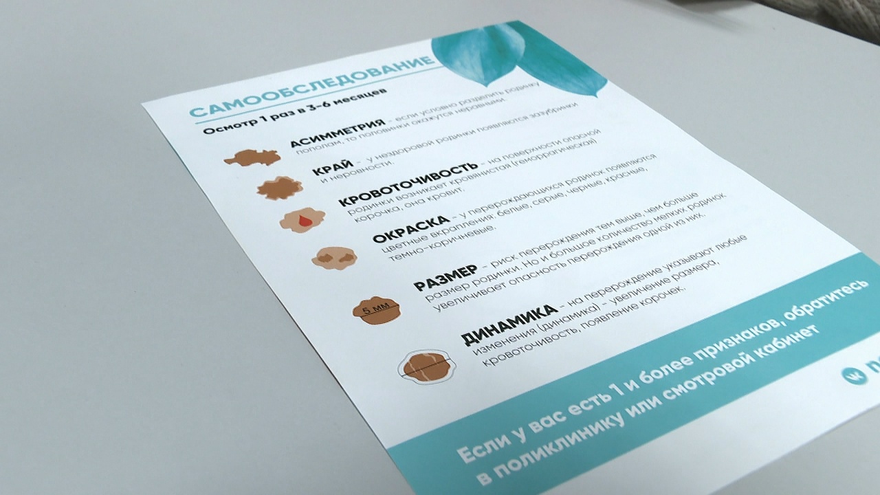 Как отличить родинку от меланомы: эксперты рассказали челябинцам, когда бить тревогу