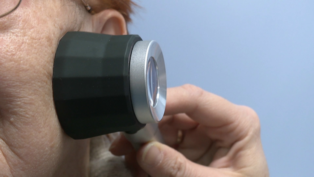 Как отличить родинку от меланомы: эксперты рассказали челябинцам, когда бить тревогу