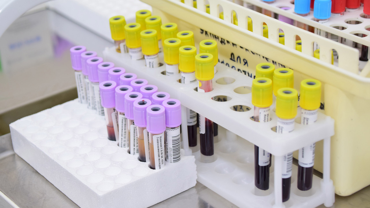 Жителям Челябинска объяснили, зачем нужен штамп о группе крови в паспорте Жителям Челябинска объяснили, зачем нужен штамп о группе крови в паспорте