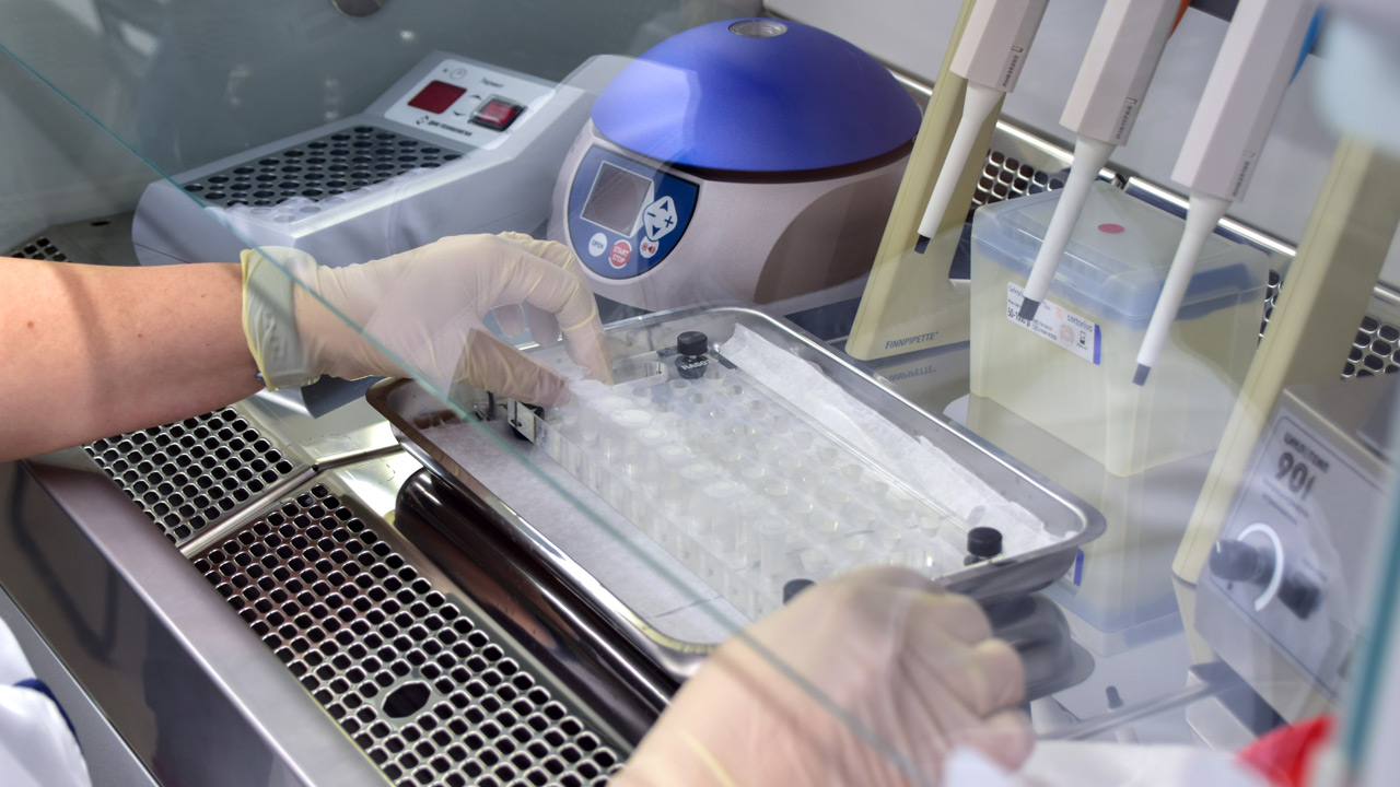 Вирус, который может вызвать рак: новый анализ в программе диспансеризации