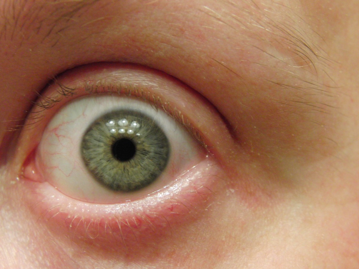 Врач из Челябинска объяснил, как распознать первые симптомы проблем со зрением